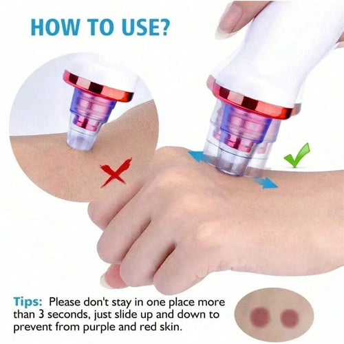 Blackhead Remover Vacuum Tool