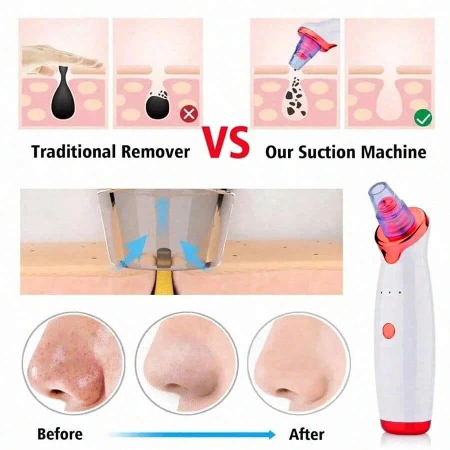 Blackhead Remover Vacuum Tool