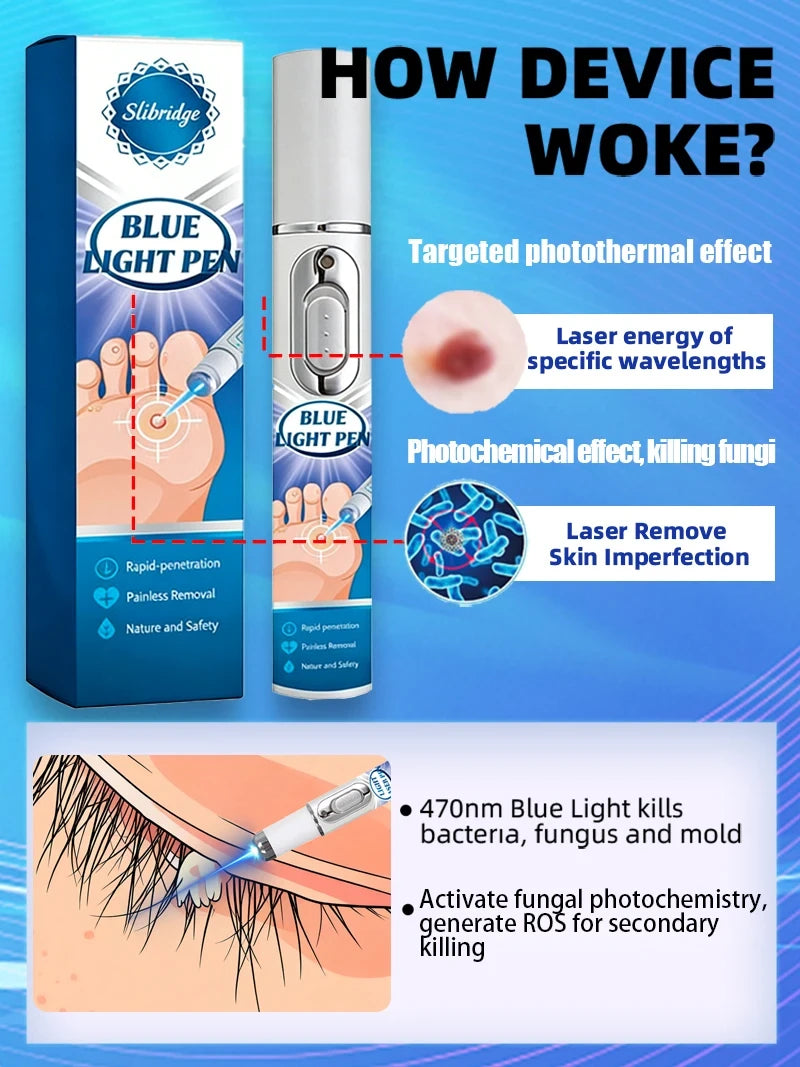 Blue Light Wart Pen
